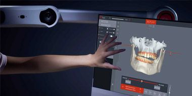 Modjaw – The Future of Jaw Motion Analysis